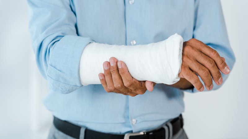 Broken Bone Injury Lawyer in Arizona