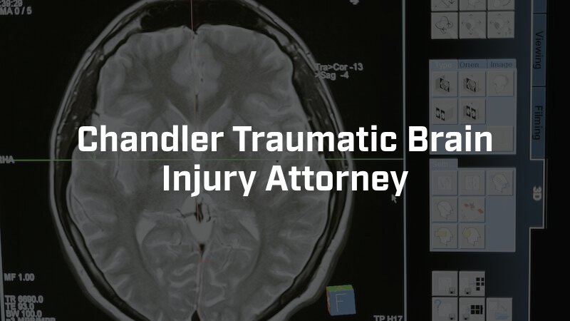 Chandler Traumatic Brain Injury Attorney