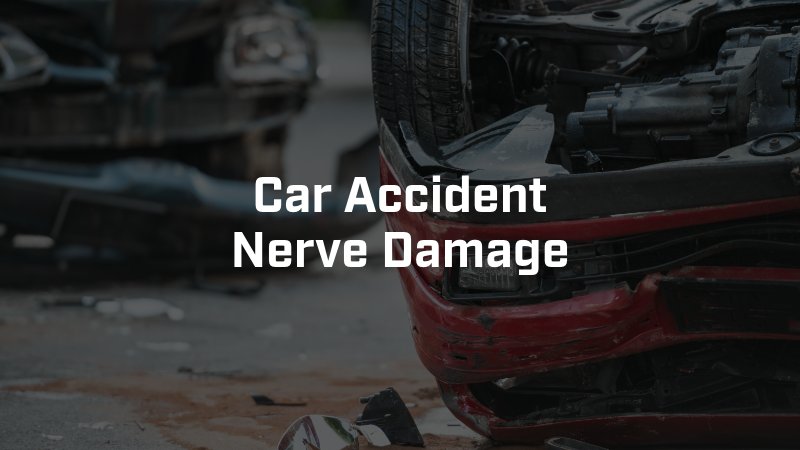 Car Accident Nerve Damage in Phoenix