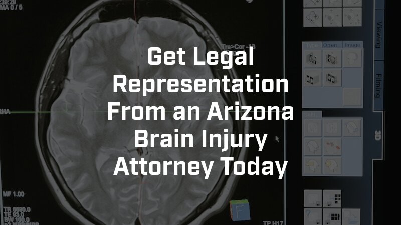 Arizona Brain Injury Attorney