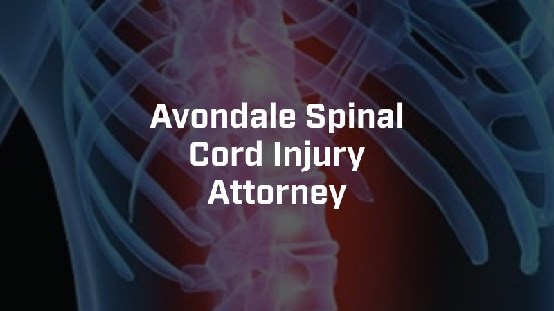 Avondale Spinal Cord Injury Attorney