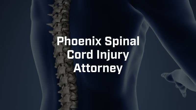 Phoenix Spinal Cord Injury Attorney