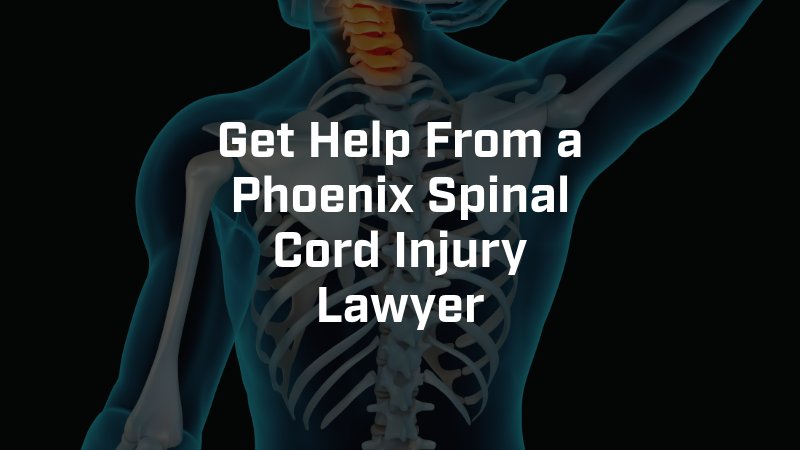 Phoenix Spinal Cord Injury Lawyer